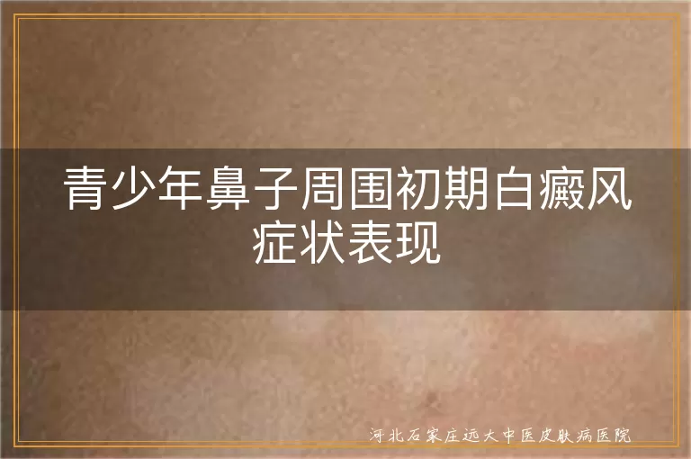 青少年鼻周早期白斑形态,白癜风初期淡白圆斑,青少年鼻旁白斑扩散信号