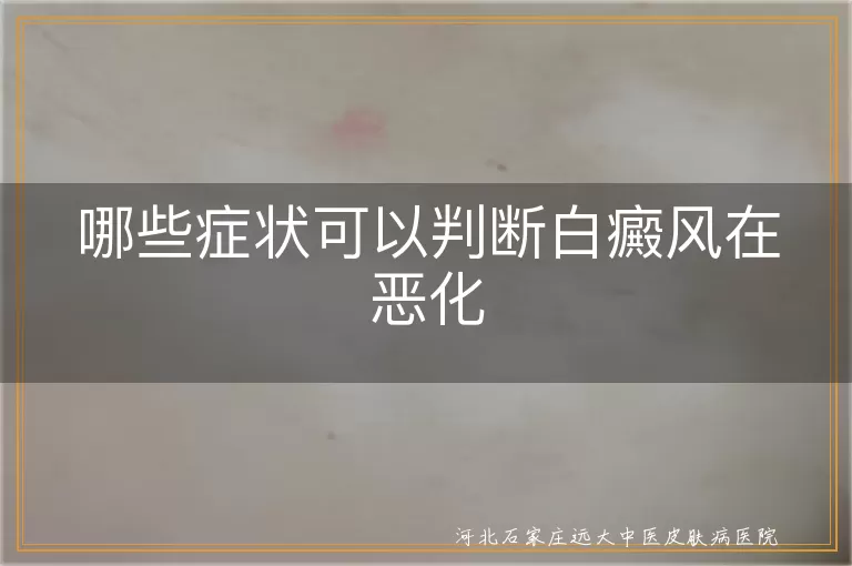 白癜风恶化信号,白斑面积新增,白斑扩散判断