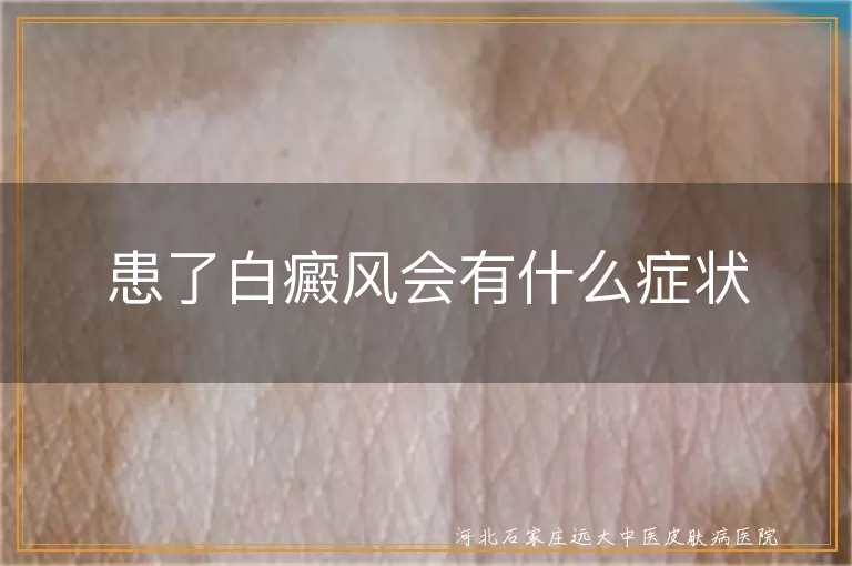 白癜风初期症状特征,白斑扩散速度表现,局部色素脱失识别
