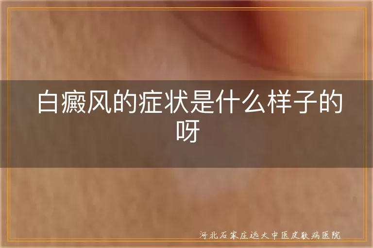 白癜风不同阶段白斑表现,早期白斑与白癜风识别的关键点,白癜风常见白斑变化有哪些