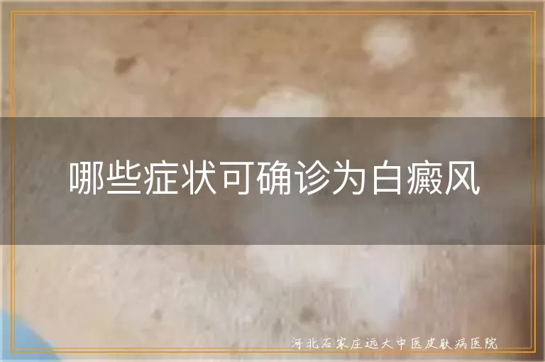 白癜风初期症状精准判断,白癜风确诊信号全面盘点,白斑与白癜风鉴别关键