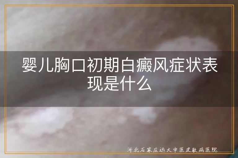 婴儿胸口白斑早期表现,新生儿胸前白癜风信号,胸口小白斑会不会是白癜风