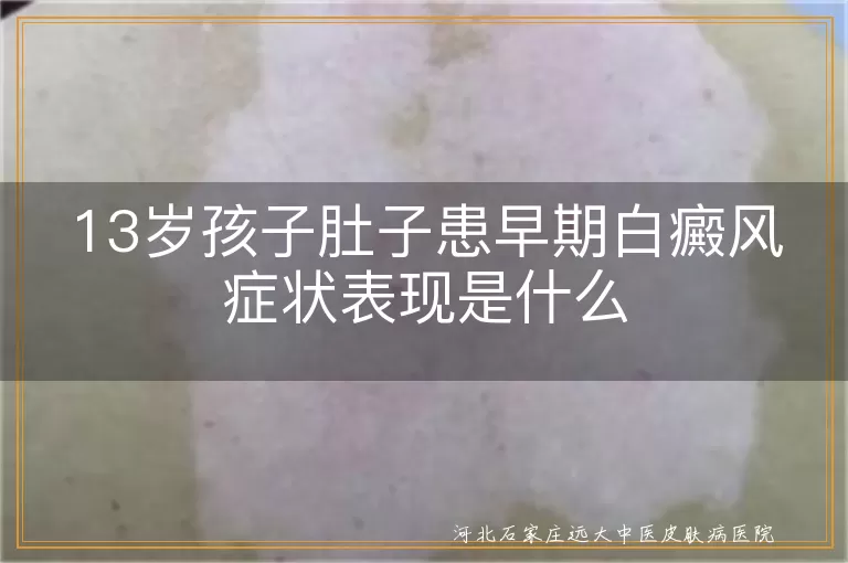 13岁孩子肚子患早期白癜风症状表现是什么