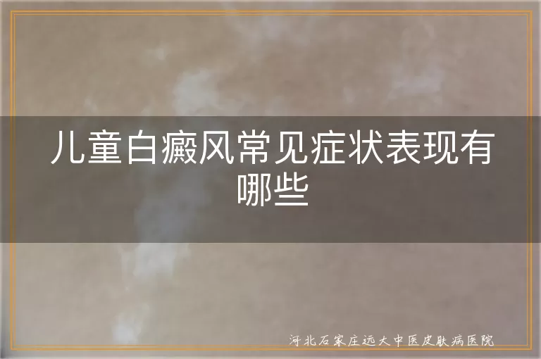 儿童白癜风常见症状表现有哪些
