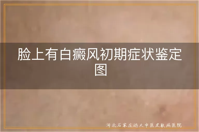 脸部白癜风早期迹象图,面部白斑初期鉴别照片,皮肤色素减退白癜风图片