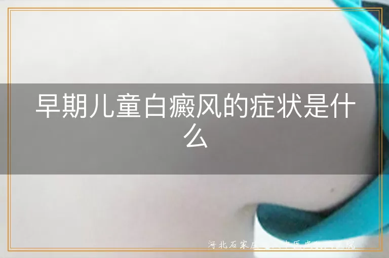 早期儿童白癜风的症状是什么