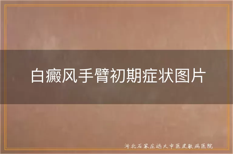 手臂白癜风早期白斑图,白癜风初期手臂白斑照片,白斑病变初期手臂症状