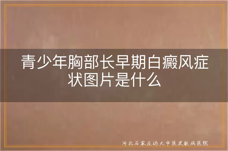 青少年胸部早期白斑表现,青春期胸前白癜风初期图,胸口白斑是不是白癜风