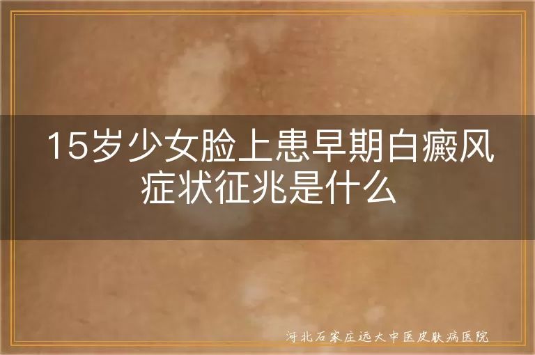 少女脸部早期白癜风有哪些表现,青春期白斑初期征兆识别,15岁女生面部白癜风症状