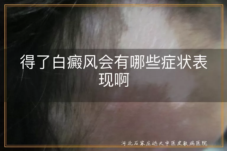 白癜风初期白斑颜色变化,白癜风白斑扩散速度快不快,白斑患处会不会痒或脱屑