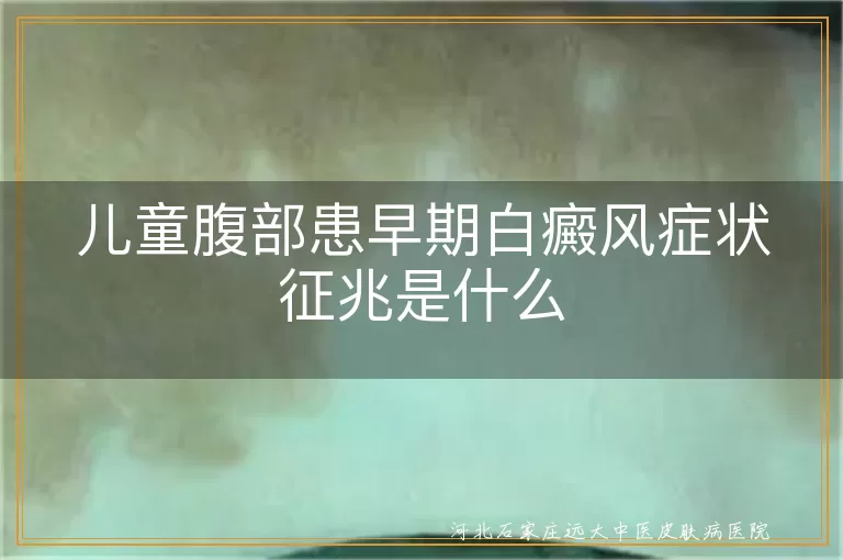 儿童腹部患早期白癜风症状征兆是什么