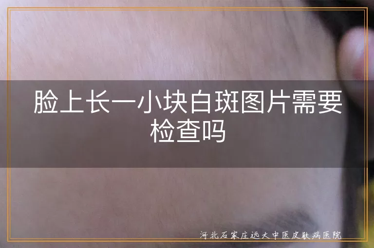 脸上长一小块白斑图片需要检查吗
