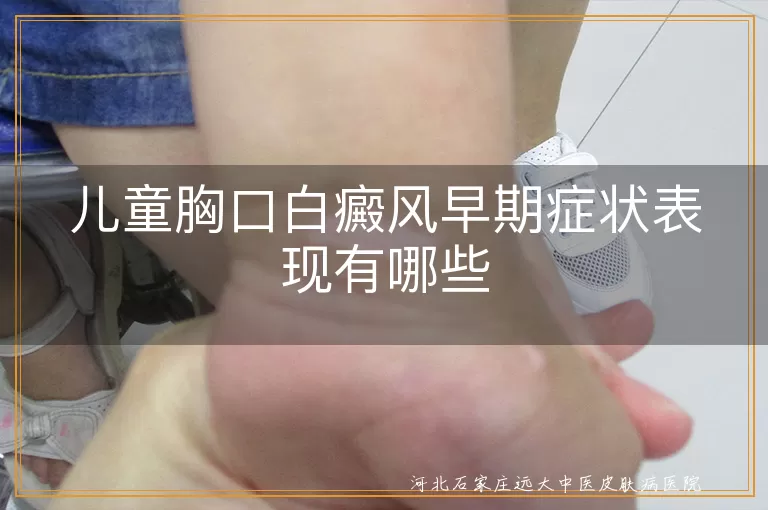 儿童胸口白癜风早期症状表现有哪些