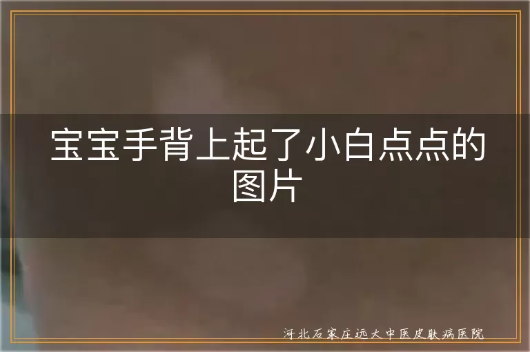宝宝手背上起了小白点点的图片