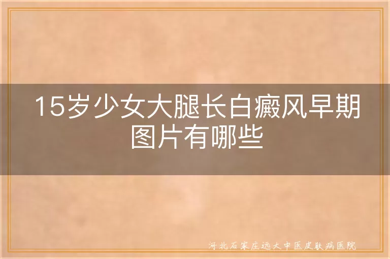 15岁少女大腿白斑初期表现,青春期白癜风早期图片,青少年腿部白斑症状识别