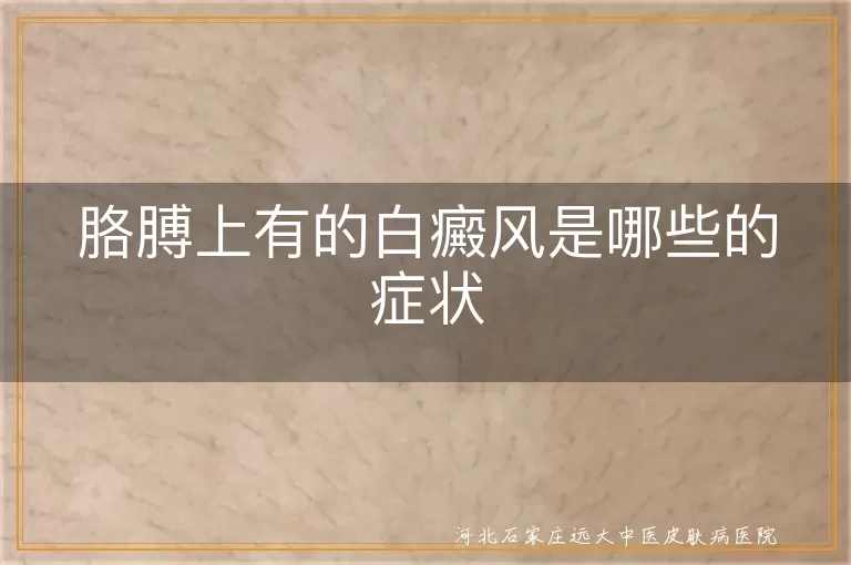 胳膊上有的白癜风是哪些的症状