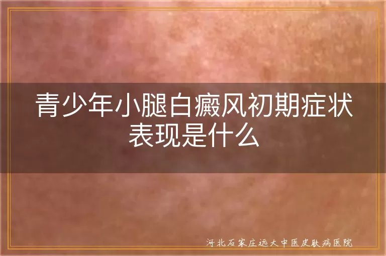 青少年小腿白癜风初期症状表现是什么
