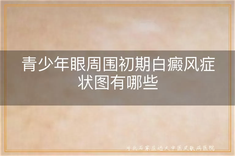 青少年眼周围初期白癜风症状图有哪些