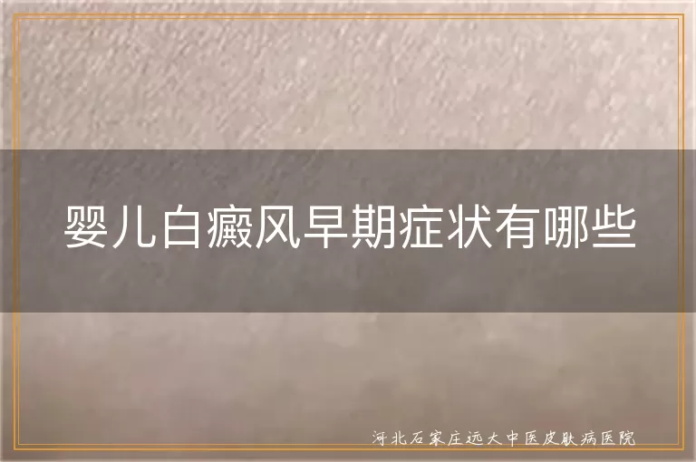 婴儿白癜风初期表现有哪些,婴儿皮肤白斑早期识别,白癜风婴儿期症状特点