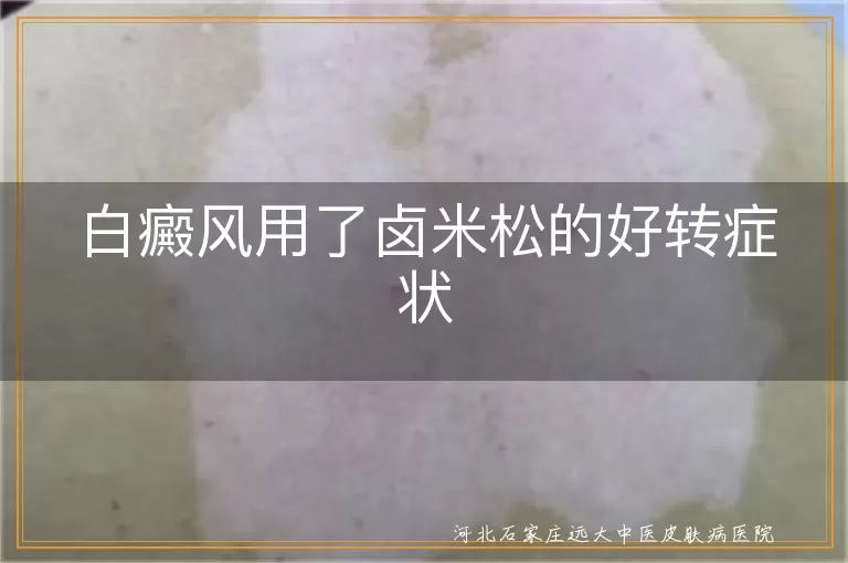 白癜风用了卤米松的好转症状