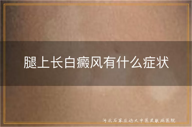 腿上长白癜风有什么症状