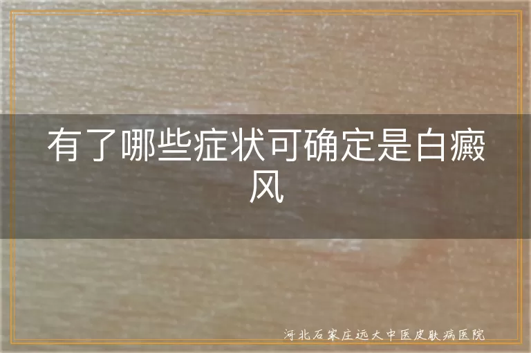 `白癜风早期典型症状表现有哪些,皮肤出现白斑如何判断是白癜风,确诊白癜风需要观察哪些特征`
