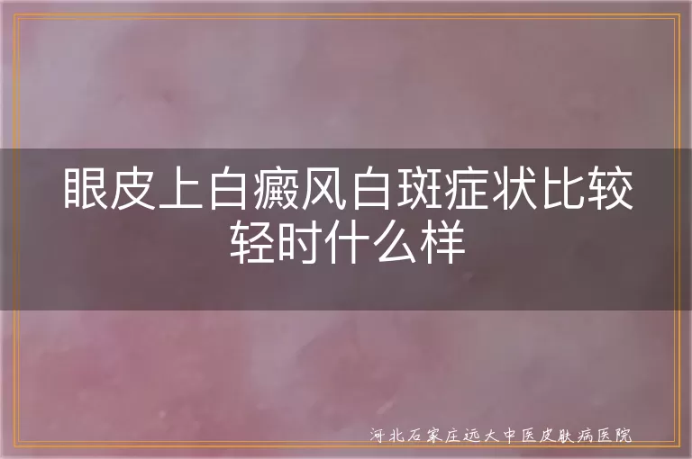 `眼皮白癜风早期症状表现有哪些,眼睑部位白斑初期症状什么样,眼部白癜风轻微时有什么特征`