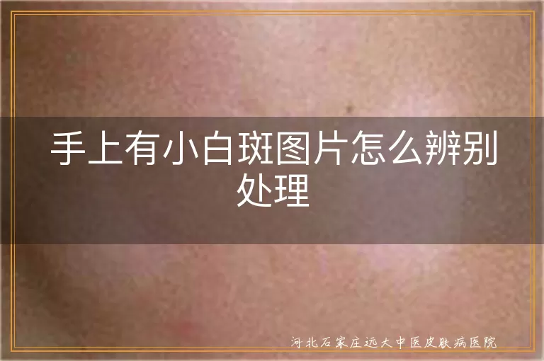 手上有小白斑图片怎么辨别处理