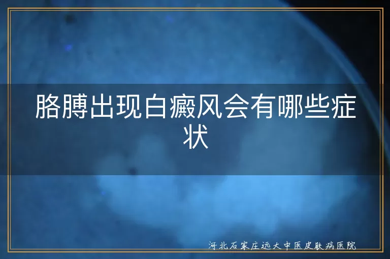胳膊白癜风的症状表现有哪些,手臂出现白斑是什么症状,胳膊上长白癜风有什么表现