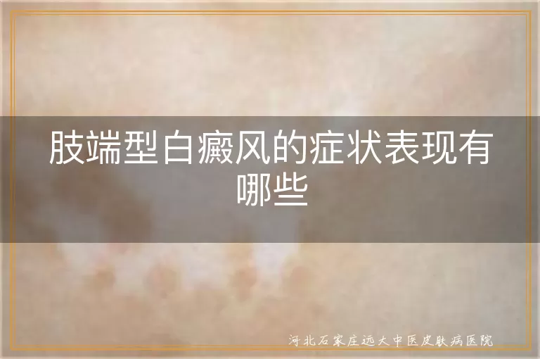 肢端型白癜风的症状表现有哪些