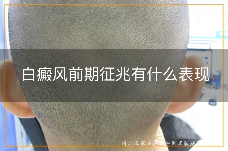 白癜风早期征兆有哪些表现图片,白斑初期症状图片是什么样子,白癜风前期皮肤变化特征图片