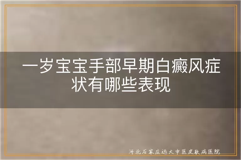 一岁宝宝手部白癜风早期症状,婴儿手上白斑初期表现,幼儿手部白癜风早期识别
