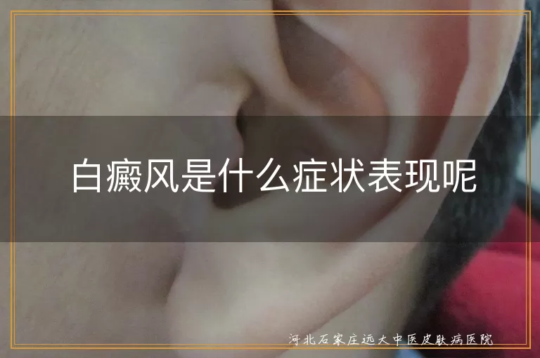 白癜风早期白斑是什么样子的图片,白斑与白癜风的区别症状表现,白癜风白斑的明显特点有哪些症状