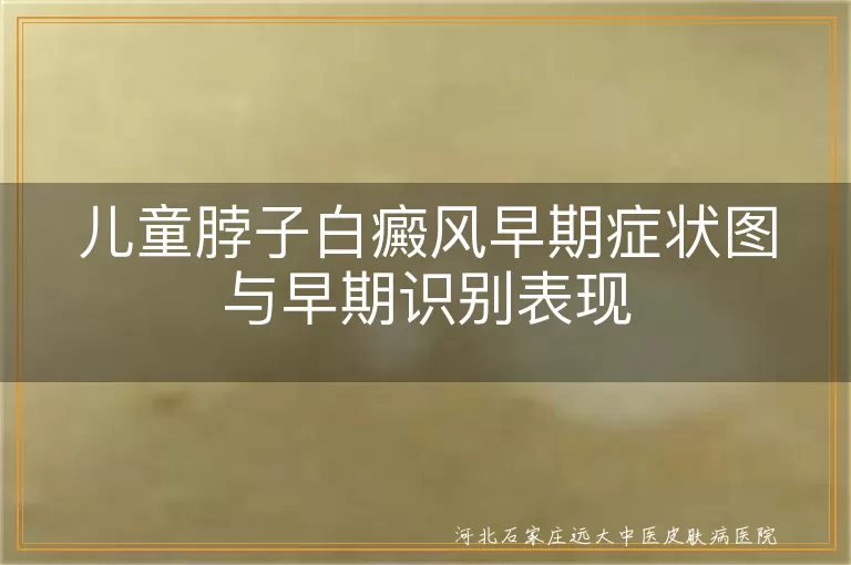 儿童脖子白斑初期症状图片,孩子颈部白癜风早期表现图,小儿脖子白斑早期图片特征