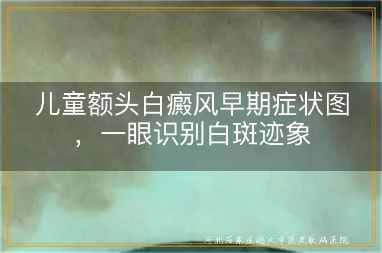 儿童额头白癜风早期白斑症状图片,小孩额头白斑是白癜风早期图,额头白癜风初期症状图片对照