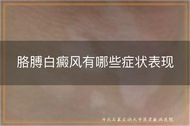 胳膊白癜风有哪些症状表现