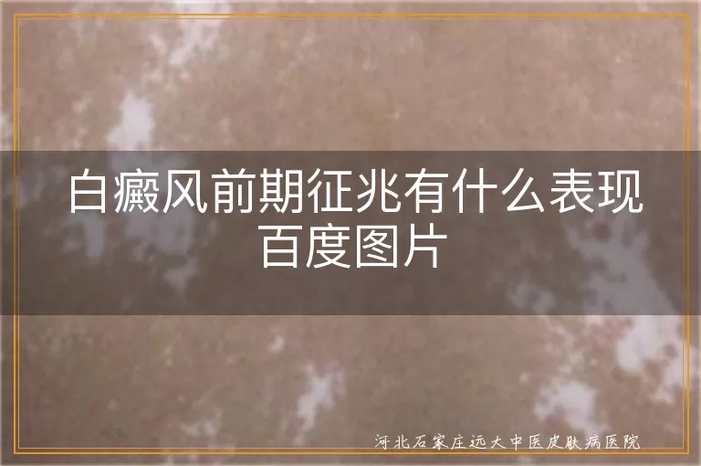 白癜风前期征兆有什么表现百度图片