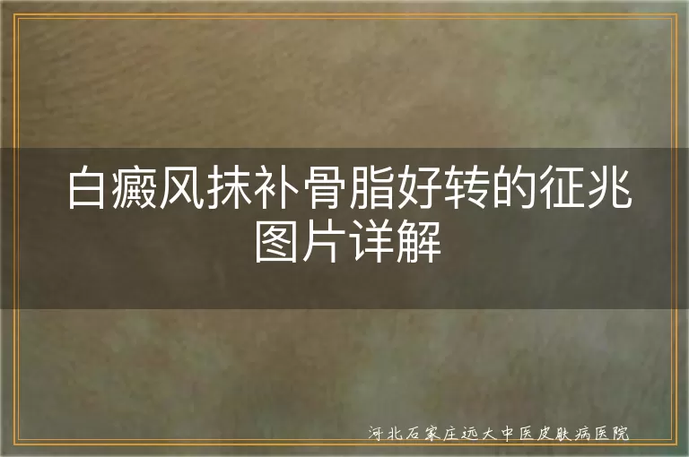 白癜风抹补骨脂好转征兆图,白斑涂补骨脂恢复迹象图片,白癜风用补骨脂见效表现照片
