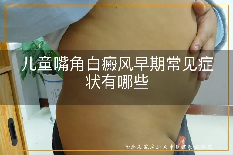 儿童嘴角白斑早期症状,孩子嘴角白癜风初期表现,嘴角有白斑是白癜风吗,儿童嘴角白癜风早期什么样,小孩嘴角长白斑怎么回事