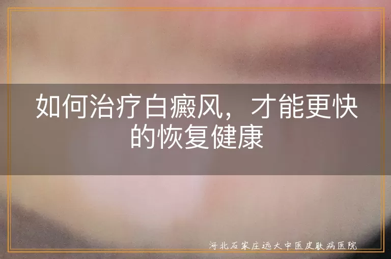 白癜风治疗,如何治疗白癜风,治疗白癜风方法