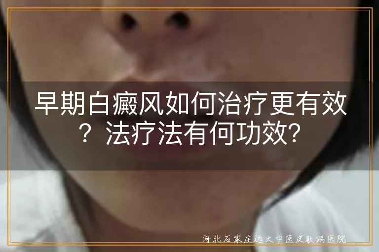 早期白癜风如何治疗更有效？法疗法有何功效？