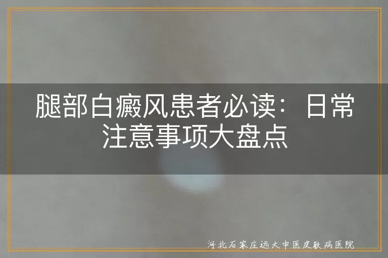 腿部白癜风患者必读：日常注意事项大盘点