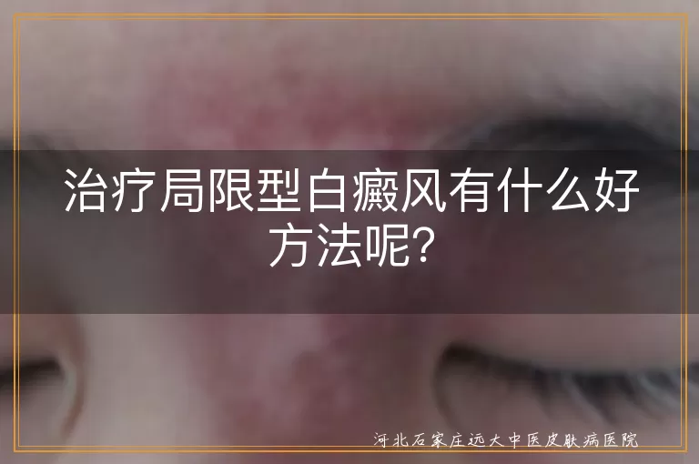 局限型白癜风,治疗方法,药物治疗,光疗,激光治疗,手术治疗,治疗小贴士,误区