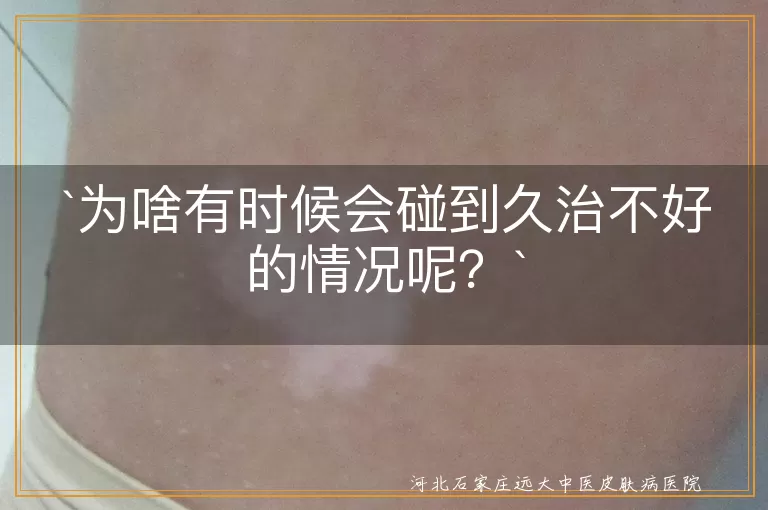 为啥有时候会碰到久治不好的情况呢？