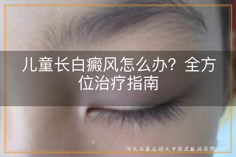 儿童白癜风,治疗方法,药物治疗,光疗,移植治疗,心理关怀,饮食调整,定期复查