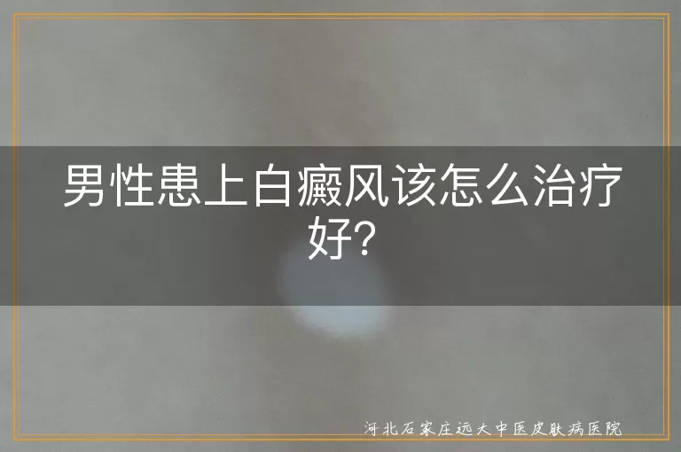 男性,白癜风,治疗,专业医生,药物治疗,光疗,激光治疗,生活习惯调整,持续关注,定期复查