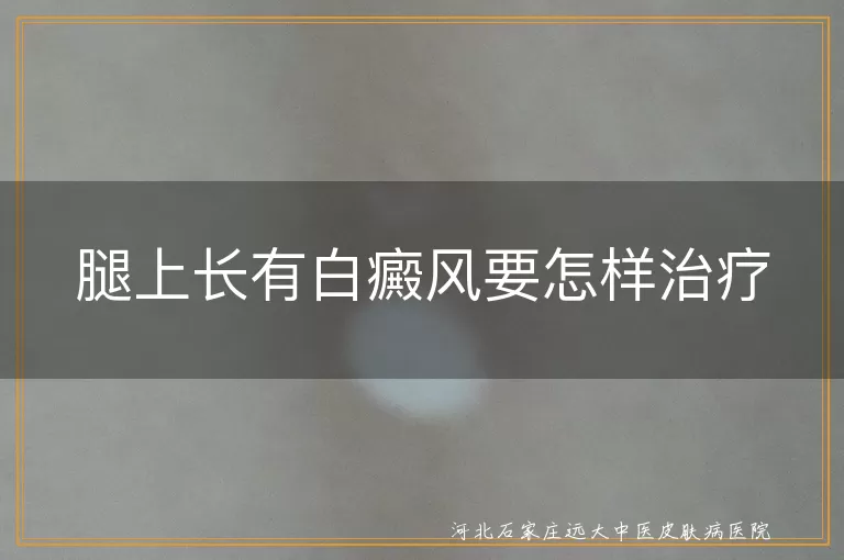 白癜风,腿上,治疗,药物治疗,物理治疗,手术治疗,心理治疗,饮食习惯,防晒,皮肤移植手术