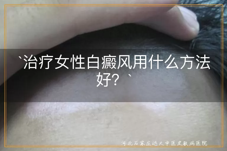 治疗女性白癜风用什么方法好？