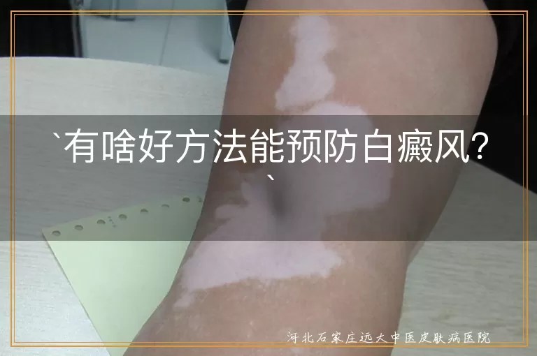 白癜风预防,生活习惯,皮肤保护,定期体检,心态乐观