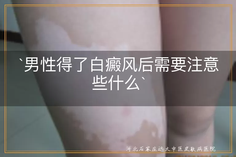 白癜风,男性,防晒,合理饮食,心态,作息,外伤,复诊,用药,心理健康